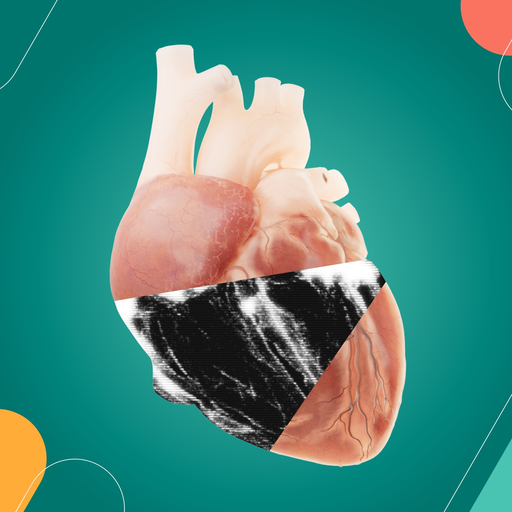 Echocardiography VR - VML 게임 이미지